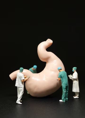 MİDE KANSERİ NEDİR,NASIL BELİRTİ VERİR,NASIL TEDAVİ EDİLİR?